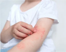 Болезни кожи и подкожной клетчатки